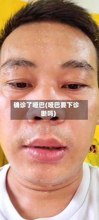 确诊了哑巴(哑巴要下诊断吗)-第2张图片