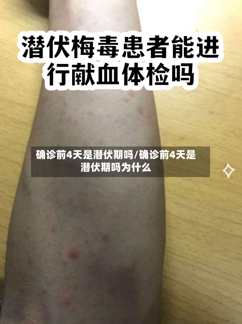 确诊前4天是潜伏期吗/确诊前4天是潜伏期吗为什么-第3张图片
