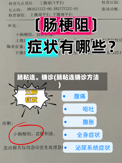 肠粘连	。确诊(肠粘连确诊方法)-第3张图片