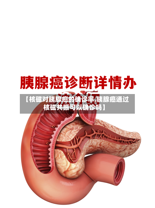 【核磁对胰腺癌的确诊率,胰腺癌通过核磁共振可以确诊吗】-第2张图片