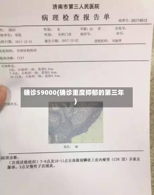 确诊59000(确诊重度抑郁的第三年)-第3张图片